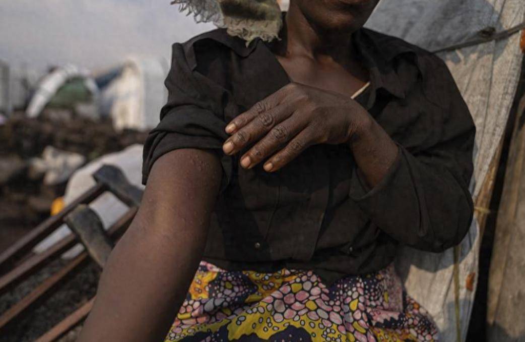 世卫拉响警报！非洲发现变异毒株